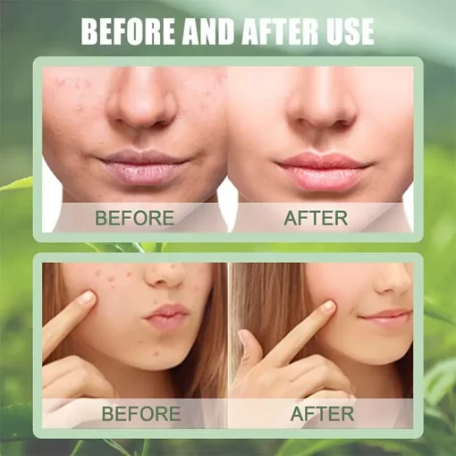 The Magic Green Stick Mask - Eluna